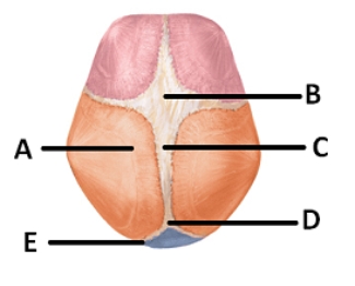 -The figure illustrates bones,fontanels,and sutures on the fetal skull.What does B represent?