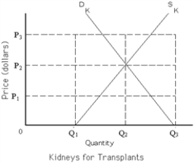 <strong>  Refer to Exhibit 4-5.If a free market were allowed in the transplanted kidney market,then the equilibrium price would be P<sub>2</sub>.The number of kidneys transplanted would increase by _________ compared to the number transplanted at a price ceiling of P= $0.</strong> A) (Q<sub>3</sub> - Q<sub>1</sub>) B) (Q<sub>3</sub> - Q<sub>2</sub>) C) (Q<sub>2</sub> - Q<sub>1</sub>) D) Q<sub>2</sub> <div style=padding-top: 35px> 