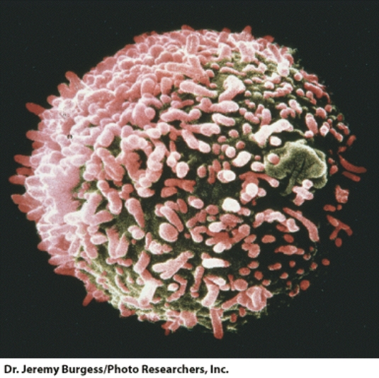 <strong>This cell is the result of fusing a: </strong> A)cancer cell and a plasma cell B)virus and a bacterium C)cancer cell and a virus D)plasma cell and a virus