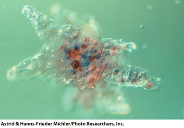<strong>This organism moves by:  </strong> A)flagella B)cilia C)pseudopodia D)cannot move <div style=padding-top: 35px> 