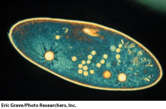 <strong>This organism moves by:  </strong> A)pseudopodia B)cilia C)flagella D)microtubules <div style=padding-top: 35px> 