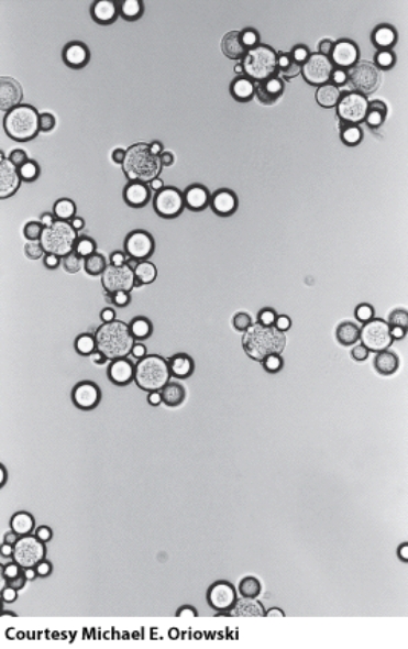 <strong>This organism belongs to the:  </strong> A)protists B)arthropods C)helminths D)fungi <div style=padding-top: 35px> 