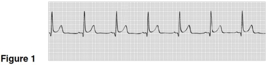 <strong> The heart rate in Figure 1 is closest to</strong> A)100. B)70. C)150. D)50.