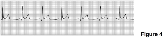 <strong>  The heart rate in Figure 4 is closest to</strong> A)100. B)70. C)150. D)50. <div style=padding-top: 35px> 