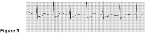 <strong> In Figure 9,the P waves are</strong> A)upright,rounded,preceding the QRS. B)inverted preceding the QRS. C)not visible. D)inverted following the QRS.