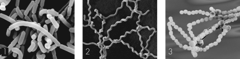 <strong>In the figure below,which depicts cocci in chains? </strong> A) 1 B) 2 C) 3 D) none of the labeled areas