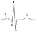 <strong> Figure 42.1 On the ECG above, within which waveform would atrial relaxation occur?</strong> A) 1 B) 2 C) 3