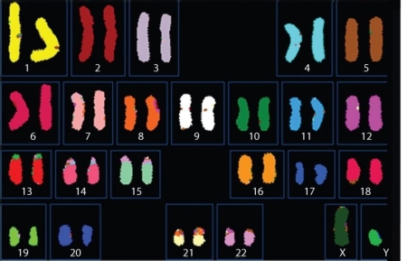 <strong> Figure 13.1 What can you infer from the karyotype shown in Figure 13.1?</strong> A) There is a translocation in one of the chromosome 8 homologues. B) This individual has an abnormal number of autosomes. C) This individual has a single sex chromosome. D) This is a karyotype of a male.