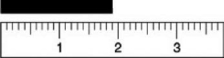 <strong>Based on the following figure, which of the measurements listed is the best estimate of the length of the object? </strong> A)1.8 cm B)1.81 cm C)1.810 cm D)1.90 cm E)1.9 cm