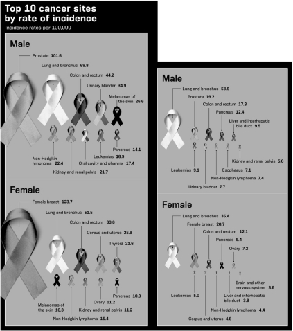 Compare and contrast the incidence rate per 100,000 individuals versus deaths per 100,000 individuals for breast cancer in females and for prostate cancer in males presented in the infographic below.What does this suggest about the survivability of breast cancer and prostate cancer?