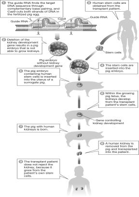 <strong>If the human transplant patient in the figure below needs a new kidney because of a genetic mutation that has made her own kidneys nonfunctional,what additional step would need to happen to produce a functional kidney for this patient?  </strong> A) The mutation that resulted in her nonfunctional kidneys should be edited or corrected before her stem cells are inserted into the pig embryo. B) Mutated kidney genes can be easily corrected after the pig embryo begins to grow. C) Nothing else needs to be done. The kidney genes in the patient's stem cells will have autocorrected themselves already. D) The mutated kidney genes should be corrected after the human kidney is harvested from the pig and before it is implanted in the human. <div style=padding-top: 35px> 
