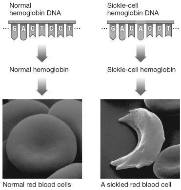 Compare the segment of DNA for normal hemoglobin DNA with the segment for sickle-cell hemoglobin DNA below.Sickle-cell disease is caused by a ________ mutation.  <div style=padding-top: 35px> 