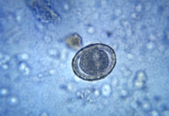 <strong>A 4-year-old child has been complaining of a stomachache and has had intermittent episodes of diarrhea. Physical examination reveals an apparently healthy child with a mildly distended abdomen. Because of the diarrhea, a fecal sample is sent for culture and for ova and parasites examination. What is the identity of that found at 400 \times in the child's fecal sample? </strong> A) Ascaris lumbricoides B) Strongyloides stercoralis C) Hookworm D) Schistosoma haematobium
