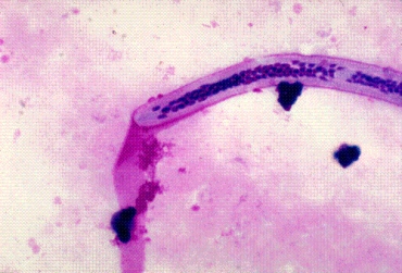 <strong>Identify the organism found in a peripheral blood thick smear at 1000 \times : </strong> A) Brugia malayi B) Loa loa C) Wuchereria bancrofti D) Onchocerca volvulus