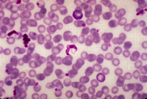 <strong>A young man from rural Brazil is visiting family in the United States when he becomes ill with muscle pains, high fever, and hepatosplenomegaly. A blood sample taken in the emergency department reveals the following organism at 1000 \times . The most likely identification of this organism is </strong> A) Leishmania donovani. B) Babesia microti. C) Plasmodium falciparum. D) Trypanosoma cruzi.