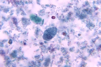 <strong>The following organism was found at 1000 \times in the fecal sample of a patient with fever and diarrhea. This organism is most likely: </strong> A) Entamoeba histolytica B) E. hartmanni C) Giardia lamblia D) E. coli