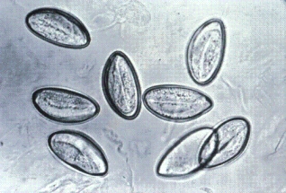 <strong>Several children at a daycare center are having trouble sleeping and are showing increasing signs of restlessness. Because one child was recently diagnosed with an intestinal parasite, the parents are informed that other children should be tested. The organism below is found at 400 \times during examination. This organism is </strong> A) Trichuris trichiura. B) Enterobius vermicularis. C) Ascaris lumbricoides. D) Hookworm.