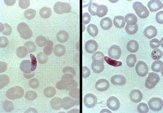 <strong>A recent emigrant from Somalia develops high fever, chills, and severe headache. Blood work on admission to the hospital reveals the following in his blood smear at 1000 \times . This patient is most likely infected with </strong> A) Plasmodium ovale. B) P. malariae. C) P. falciparum. D) P. vivax.