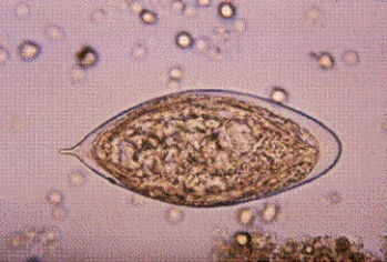 <strong>An international male student from Egypt comes to the campus clinic complaining of blood in his urine. A urinalysis reveals the parasite seen below at 400 \times . This organism is </strong> A) Schistosoma mansoni. B) S. japonicum. C) S. haematobium. D) S. madurella.
