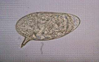 <strong>A patient who has traveled to Puerto Rico comes to a clinic with a history of diarrhea for the past 2 weeks. A fecal sample collected for O&P shows the following parasite at 400 \times . This organism is most likely </strong> A) Schistosoma mansoni. B) S. japonicum. C) S. haematobium. D) S. madurella.