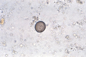 <strong>A patient finds a small ribbonlike object in his stool and reports this to his physician. The physician orders a fecal ova and parasite analysis that reveals the following egg in the sample at 400 \times . The most likely identity of this parasite is </strong> A) Hymenolepis nana. B) Taenia spp. C) Diphyllobothrium latum. D) Paragonimus westermani.
