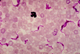 <strong>A young man who returned a week ago from a family vacation to Kenya develops a high fever and delirium. Although he was compliant with his antimalarial medications, a blood sample is taken to rule out malaria. The laboratory scientist sees the following on the blood smear at 1000 \times . This organism is most likely </strong> A) Trypanosoma brucei. B) Leishmania donovani. C) Wuchereria bancrofti. D) Loa loa.