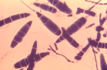 <strong>The following organism is isolated from a case of tinea capitis. The organism grew rapidly producing tan mold colonies. This organism is most likely  </strong> A) Trichophyton rubrum. B) Epidermophyton audouinii. C) Fonsecaea compacta. D) Microsporum gypseum. <div style=padding-top: 35px> 