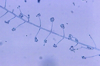 <strong>A student working for the summer at a plant nursery has a nodular lesion on his forearm that develops a draining tract. The following organism is isolated from the culture at 22° C. Identify the organism from the following:  </strong> A) Trichosporon boydii B) Sporothrix schenckii C) Trichophyton rubrum D) Microsporum canis <div style=padding-top: 35px> 