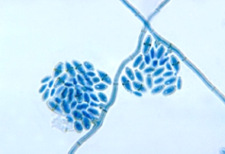 <strong>A young man notices a darkened area of skin on the palm of his hand. It seems to be increasing in size over the past 2 weeks. His health care provider collects a skin scraping for microscopic examination, which shows septate hyphal elements and budding cells. This organism is most likely  </strong> A) Malassezia furfur. B) Mucor spp. C) Hortaea werneckii. D) Microsporum canis. <div style=padding-top: 35px> 