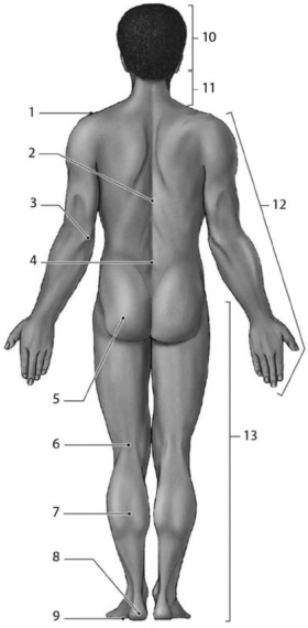 <strong> Figure 1-3 Anatomical Landmarks Use Figure 1-3 to answer the following questions: The kneecap is patellar,whereas the back of the knee is</strong> A) crural. B) pedal. C) manual. D) popliteal. E) pubic.