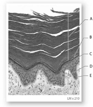 <strong> Photo Credit: Robert B. Tallitsch Figure 5-2 The Strata of the Epidermis in Thick Skin Use Figure 5-2 to answer the following questions: The lowest level of cells of the strata,marked E,consists of</strong> A) keratin protein. B) collagen fibers. C) dead cells. D) carotene-producing cells. E) mitotically active epithelial cells.