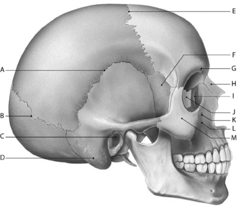 Figure 6-2 Adult Skull (Lateral View) Use Figure 6-2 to identify the labeled part. -Structure E is the joint between the ________ and ________ bones.