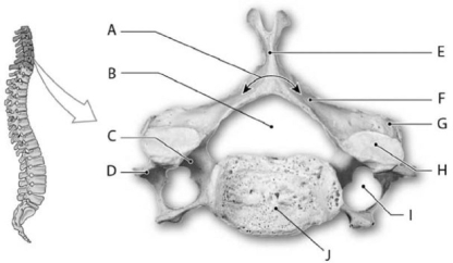Photo Credit: Ralph T. Hutchings Figure 6-3 A Cervical Vertebra (Superior View) Use Figure 6-3 to identify the labeled part. -What type of vertebra is this?
