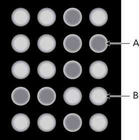 <strong>The figure below is a fluorescence readout from a lectin array.What can be deduced from A? </strong> A) There is no interaction between the glycan and the lectin in the well. B) There is a glycan-lectin interaction in the well. C) There is an interaction, but there is no way to determine the species that are interacting. D) Glycan cleavage from the glycoconjugate has been achieved.