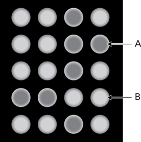 <strong>The figure below is a fluorescence readout from a lectin array.What can be deduced from B? </strong> A) There is no interaction between the glycan and the lectin in the well. B) There is a glycan-lectin interaction in the well. C) There is an interaction, but there is no way to determine the species that are interacting. D) Glycan cleavage from the glycoconjugate has been achieved.