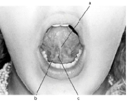 <strong>In the following illustration,structure c is the </strong> A) sublingual fold B) sublingual caruncle C) lingual frenum