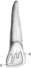 In the following illustration,structure a refers to a fossa,which is a convexity or bulge on a tooth.Structure b refers to a ridge,which is a concavity or depression within a tooth.
