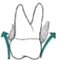 <strong>Which illustration depicts an overcontoured restoration?</strong> A) B) C)