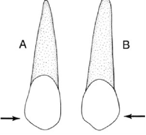 <strong>In the illustration below,figure A is a </strong> A) maxillary central incisor B) maxillary lateral incisor C) mandibular canine D) maxillary canine