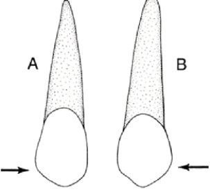 <strong>In the illustration below,Figure B is a </strong> A) maxillary central incisor B) maxillary lateral incisor C) mandibular canine D) maxillary canine