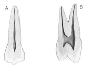 <strong>Figure A below is which tooth? </strong> A) Maxillary right second premolar B) Maxillary left second premolar C) Maxillary right first premolar D) Maxillary left first premolar