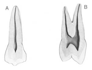 <strong>Figure B below illustrates a view of which surface? </strong> A) Buccal B) Lingual C) Mesial D) Distal