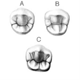 <strong>In figure A below,identify the tooth,the number of cusps,and groove pattern. </strong> A) Mandibular first premolar;two cusps;C groove pattern B) Mandibular second premolar;two cusps;Y groove pattern C) Mandibular first premolar;two cusps;H groove pattern D) Mandibular second premolar;two cusps;U groove pattern