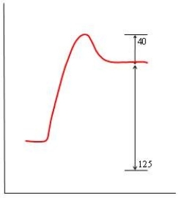 <strong>In each of the following diagrams, the x-axis is the reaction coordinate and the y-axis is the potential energy. Which diagram corresponds to a reaction that has an activation energy of 40 kJ and an overall reaction energy of -125 kJ?</strong> A) B) C) D)