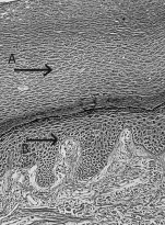 <strong>The letter A in the above figure represents </strong> A)keratin-filled, dead epithelial cells. B)replicating epithelium. C)mucus produced by underlying ciliated cells. D)white blood cells attacking a bacterial cell. E)all of these.