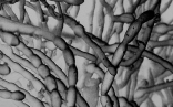 The above photomicrograph is of  