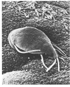 To which of the following groups does the organism in the above figure belong?