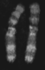 The above figure represents  