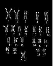 <strong>The above figure reveals which of the following about the organism that it was obtained from? </strong> A)male B)female C)human D)mouse E)two of these are correct