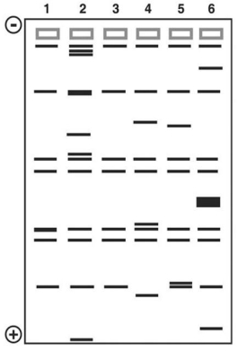 <strong>Figure 10.3 This figure shows the results of a gel electrophoresis separation of restriction fragments of the DNA of different organisms.   In Figure 10.3,which two are most closely related?</strong> A)1 and 3 B)2 and 4 C)3 and 5 D)2 and 5 E)4 and 5 <div style=padding-top: 35px> 